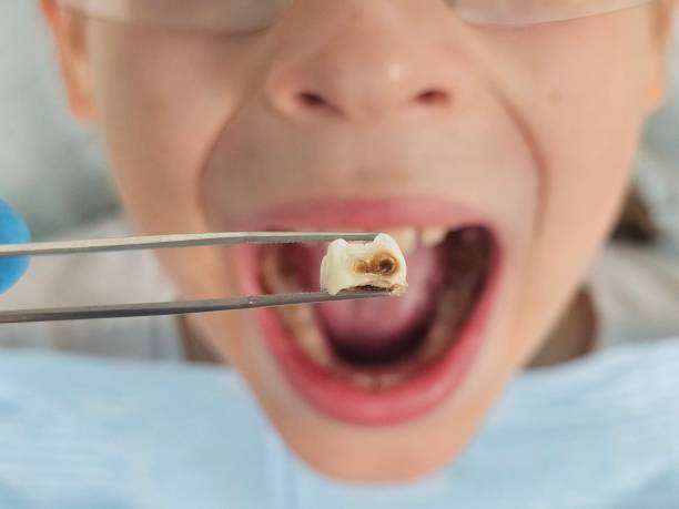 Best Urgent Dental Care for Toothaches in Lake Telemark, NJ