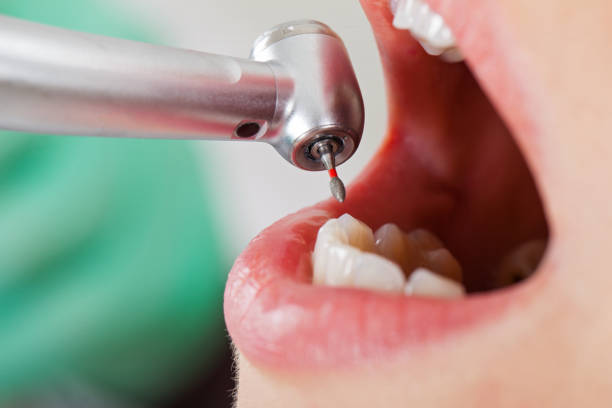 Best Emergency Care for Gum Disease in Lake Telemark, NJ